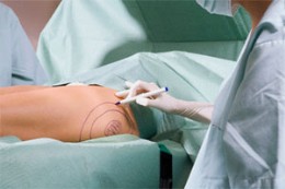 cosmetic surgery